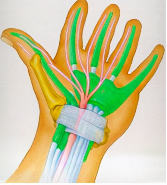 手腕疼痛需要拍片子吗,手腕肿痛ct可以查吗