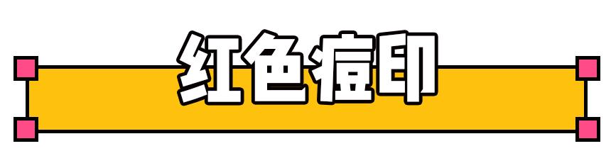 十大公认祛痘印效果最好的方法,教你几招祛痘印的最快方法