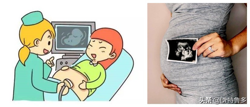 怀孕初期照了x光有影响吗,照了手部x光当月怀孕了有影响吗