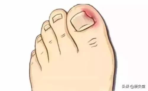 夏天艾灸该艾灸哪几个位置,又到了艾灸的季节