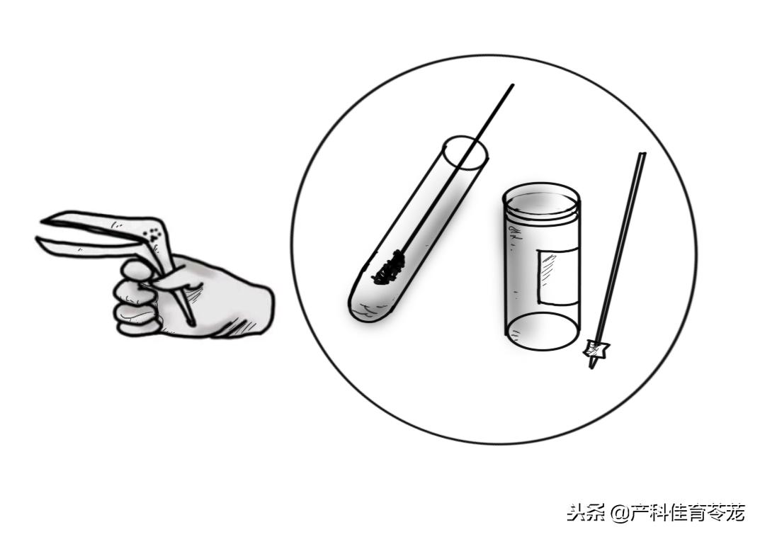 要做妇科手术要不要和男朋友说,什么妇科手术需要休息15天