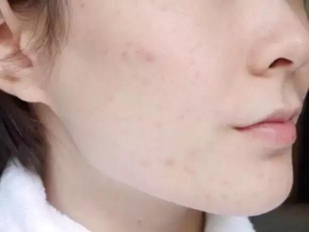 自带磨皮特效粉底液,自带磨皮效果的粉底液