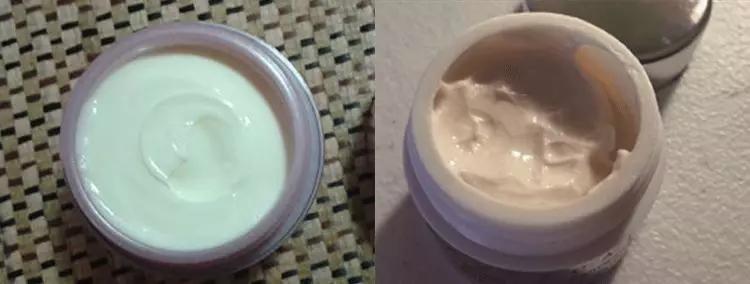 别再用针挑！用米澳拉，脂肪粒自己“掉”下来，效果胜过医美激光