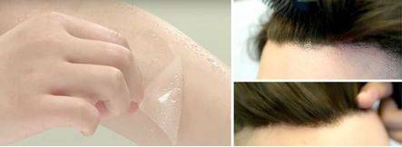 突如其来是什么原因引起的,突如其来的脱发