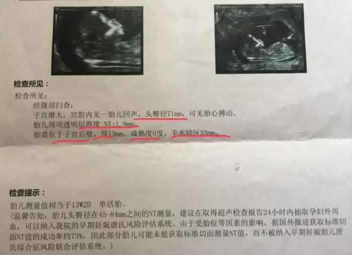 胎儿健康程度做什么检查,怎样能看出胎儿是否健康