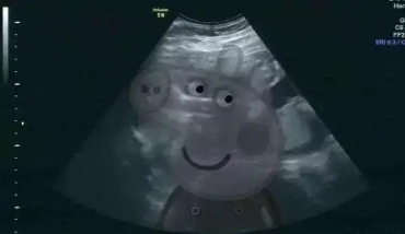 怀孕多久做B超比较好,怀孕多久做b超可以查到孕囊