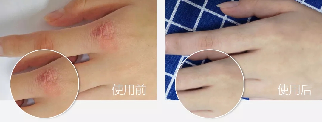 蔡依林的腿值多少钱,蔡依林最迷人的鞋