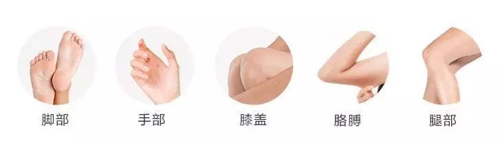 手脚干裂皮肤又厚又痒怎么办,冬天手脚干裂起皮怎么治疗