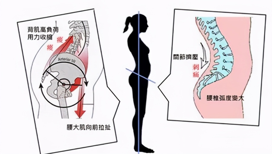 产后如何瘦脚最有效,产后怎么练脚变小