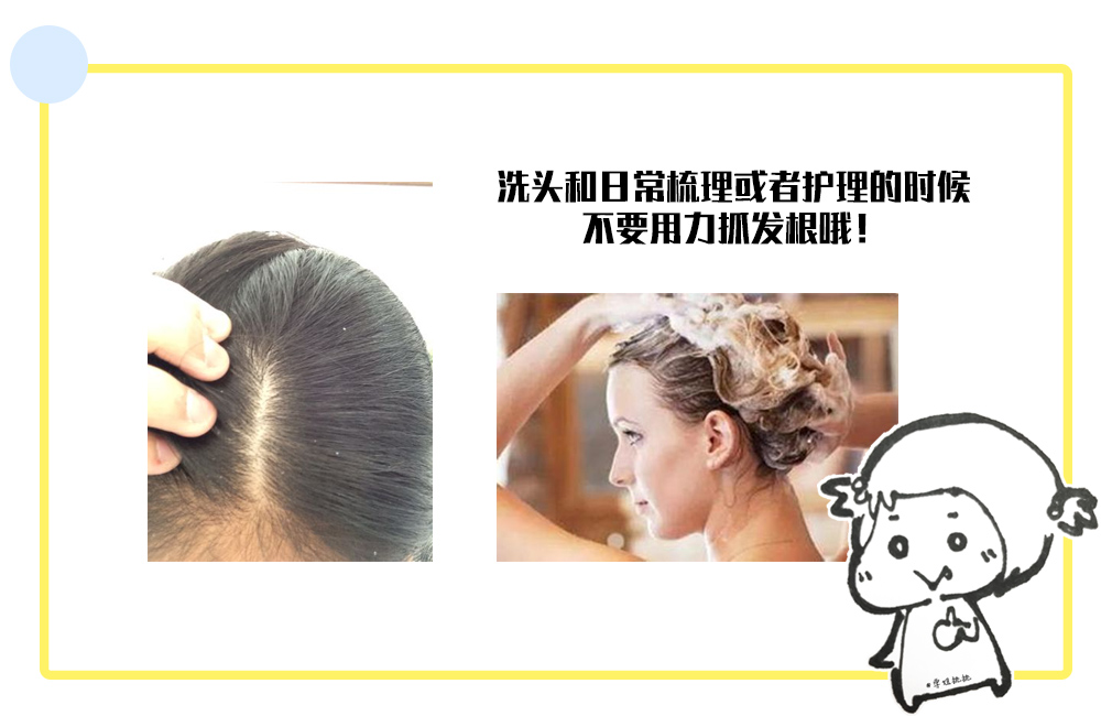 发际线高女生怎么变美,短脸发际线高变美思路