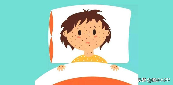 hiv的小红疹长什么样,hiv的小红点是病毒疹吗