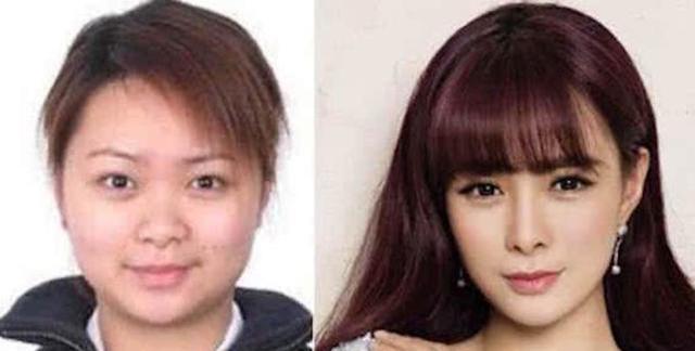 盘点一些有问题的鼻子,明星都没整好的鼻子