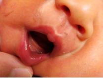 鐗欓緢涓婂皬鑲跨槫,鐗欓緢涓婄殑鑲跨槫