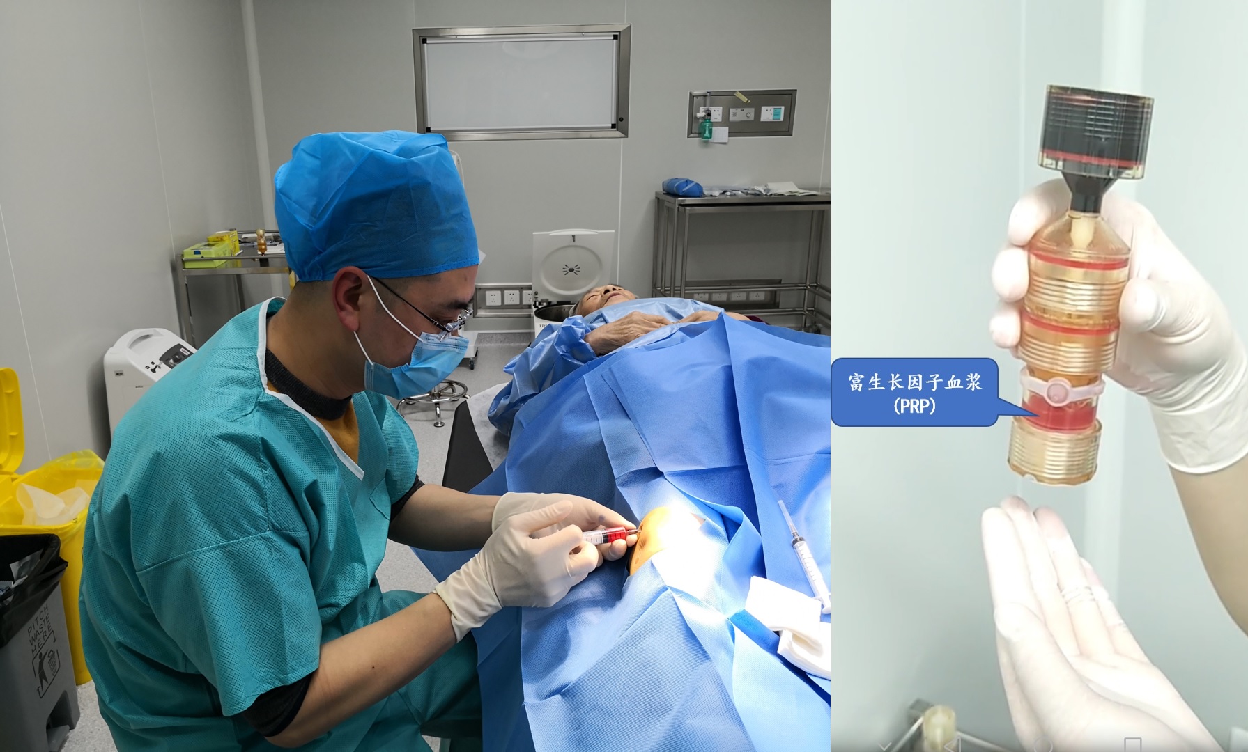 用prp治疗膝关节炎有消炎作用吗,骨关节炎打了prp后能管多久