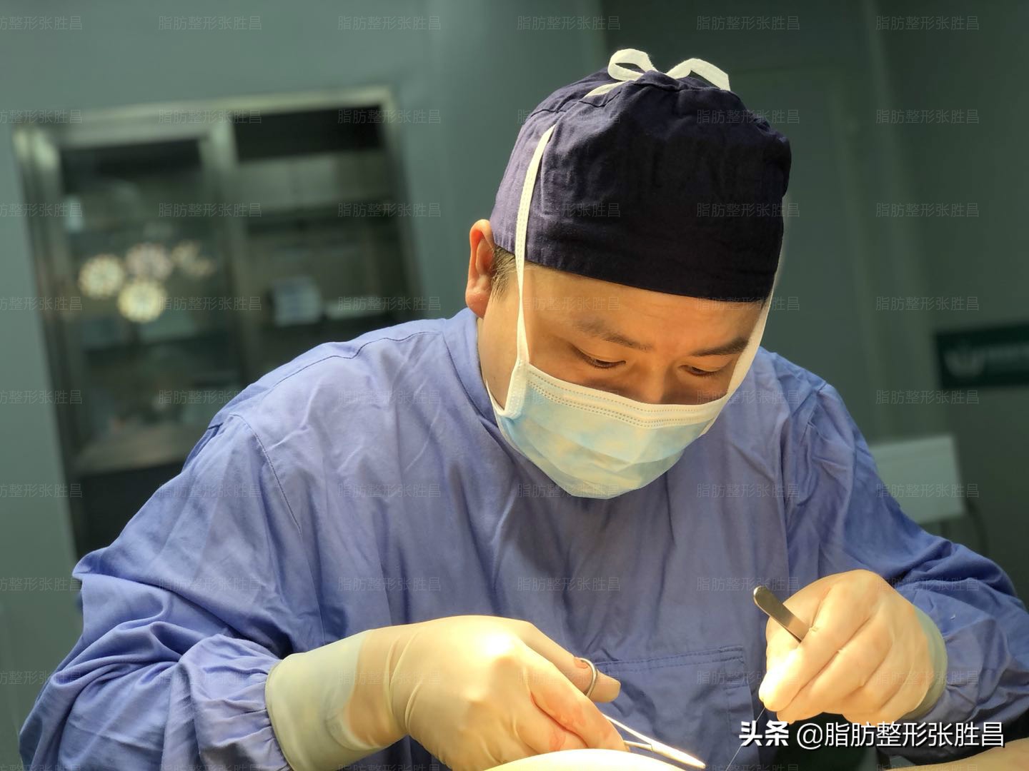 大腿环吸多长时间减腿围,大腿环吸后如何更好塑形