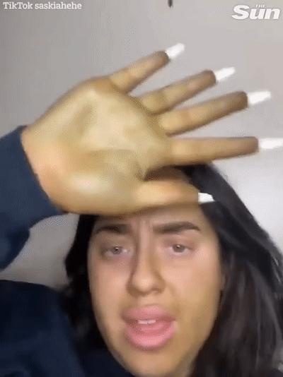 美国妹纸使用过期一年的美黑乳液,全身变绿,自嘲变成怪物史莱克