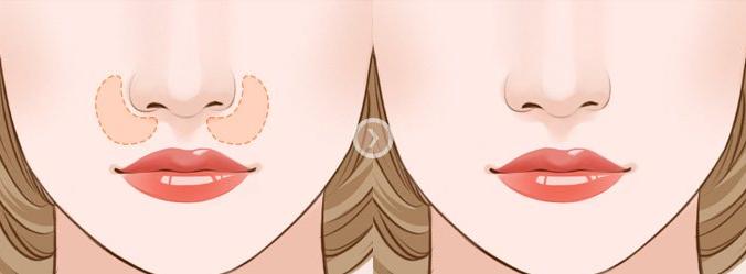 三招改善法令纹,一招就可以把你的法令纹淡下去