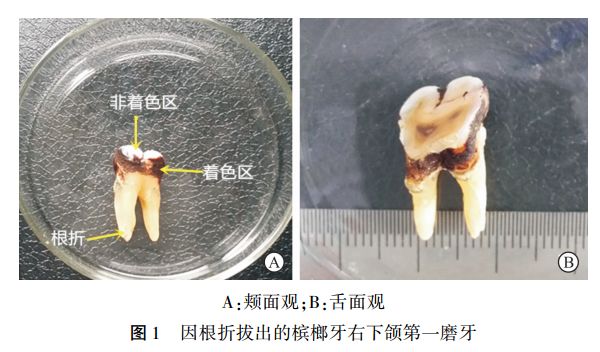 从年销百亿到禁止广告，这种「恶魔果实」就在我们身边