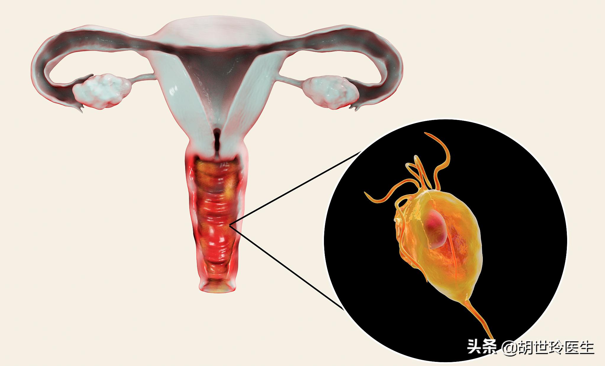 50岁女人妇科病的症状,妇科病盆腔炎有哪些症状