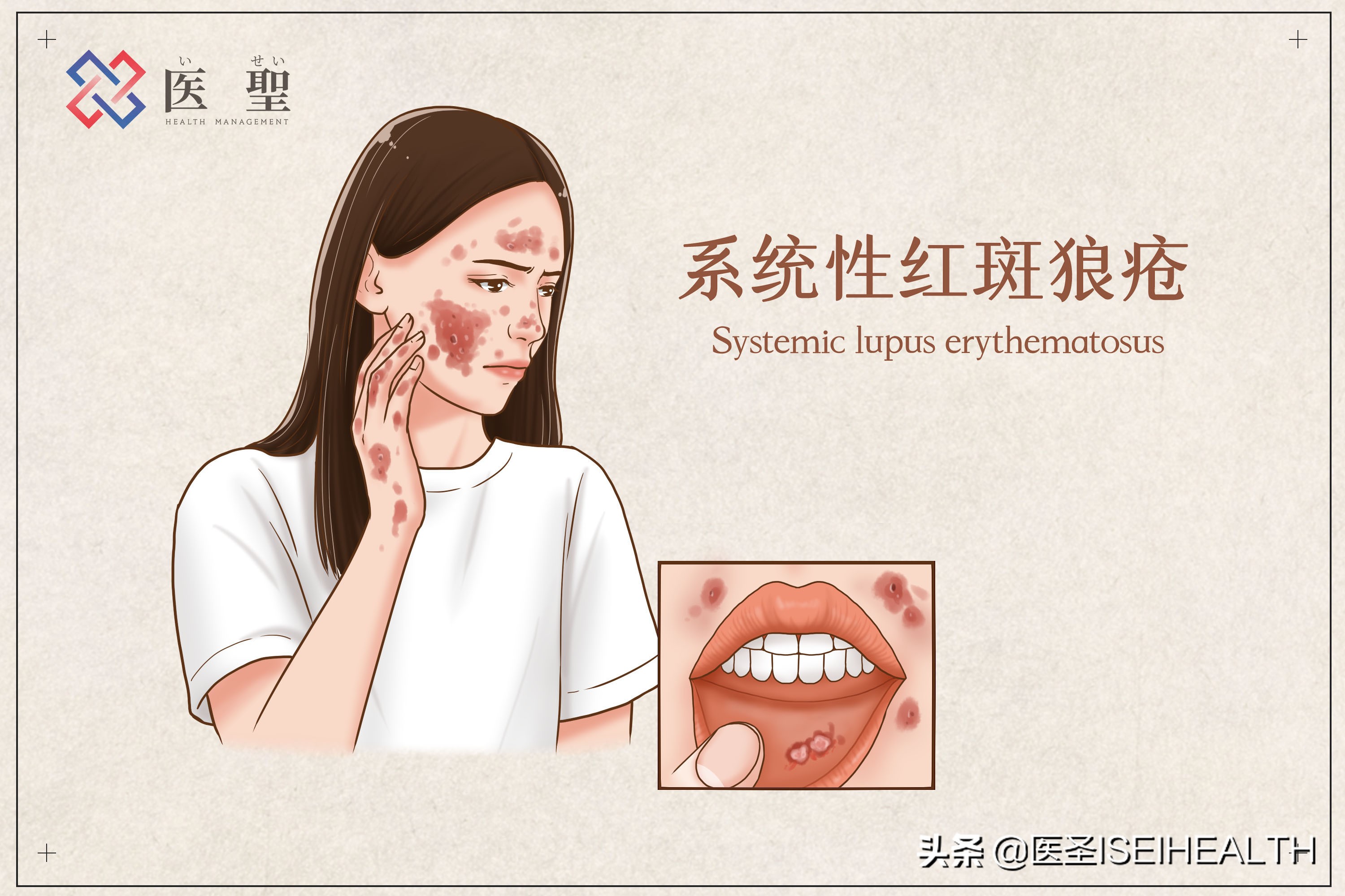 再生干细胞治疗1型糖尿病,再生医学治疗糖尿病