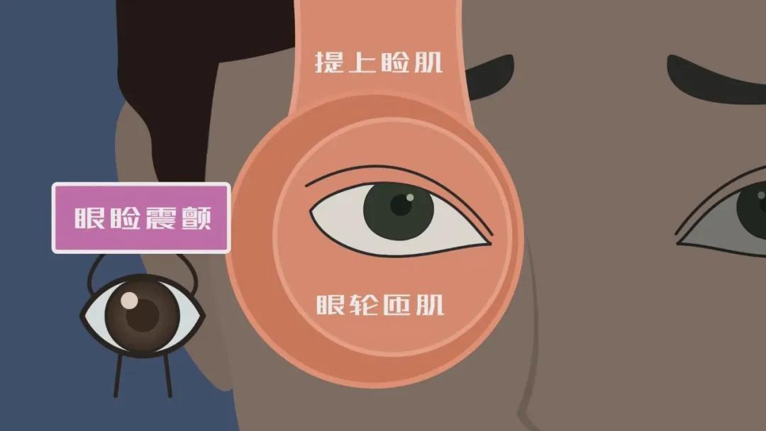 左眼跳财右眼跳灾的真正原因,左眼跳财右眼跳灾的真实原因