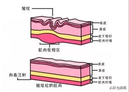 辛芷蕾是苦相女生吗,辛芷蕾气质怎么养成