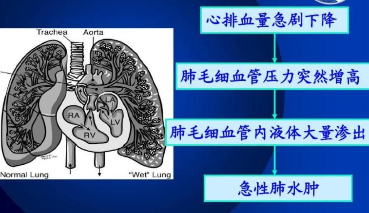 经常咳嗽白色的泡沫粘液,咳嗽痰多白色泡沫痰粉红色
