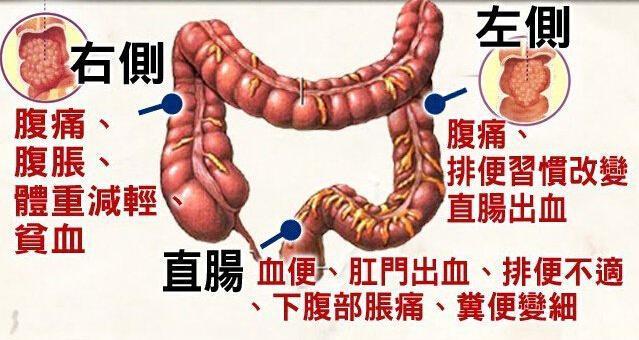 癌症已转移化疗有效吗,癌症有转移还有手术必要吗