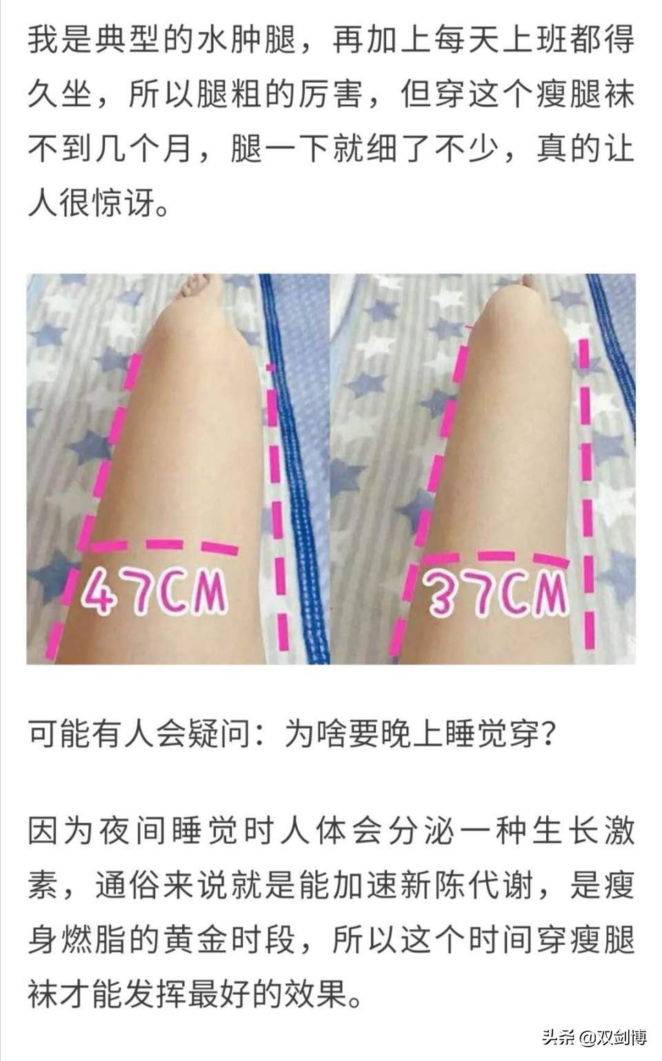 肌肉腿穿静脉曲张袜能瘦腿吗,静脉曲张袜子真的能瘦腿吗