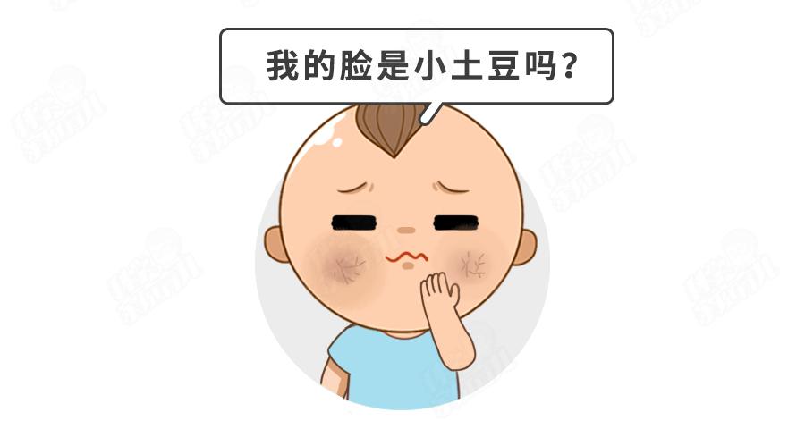 最近曝光的宝宝霜,宝宝霜的成分安全么