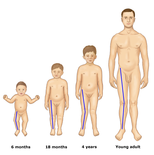 孩子o型腿是下肢没力量吗,颈椎病压迫椎动脉头晕如何缓解