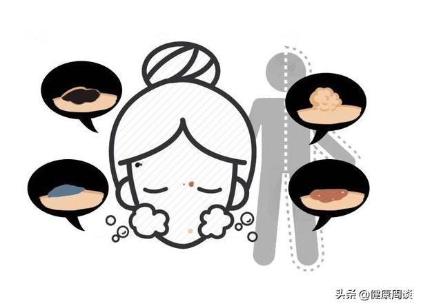 身上突发的肉疙瘩是瘤？会癌变？医生：或与5种疾病有关，需留意