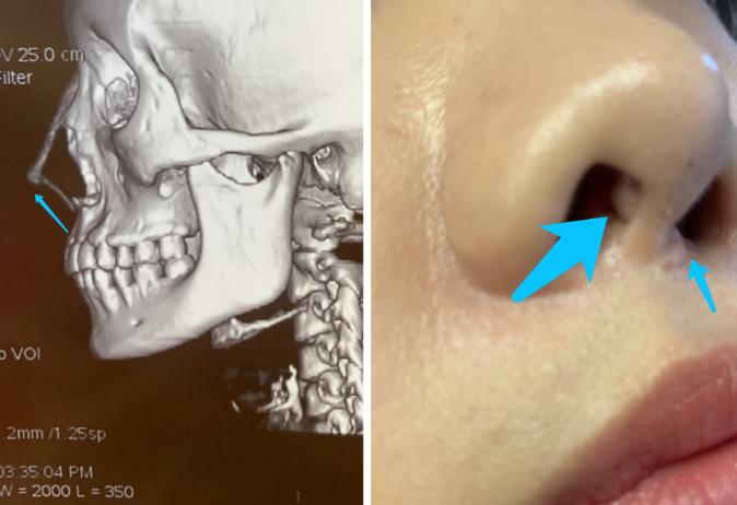 新氧公益救助视频,新氧公益是真的吗