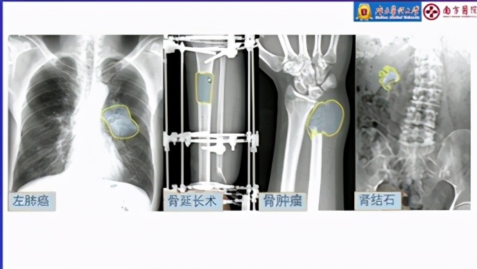 就业满意度大学排名,近三年毕业生就业满意度专业排名