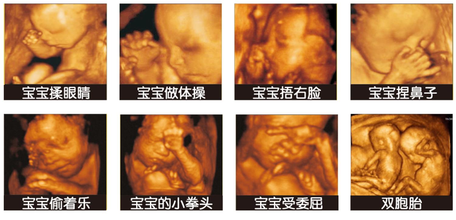 准妈妈被宝宝丑哭了,四维照的宝宝怎么这么丑