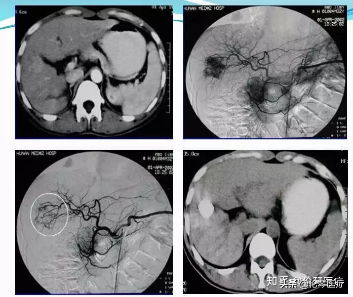 瑞金医院王忠敏,瑞金医院王忠敏简介