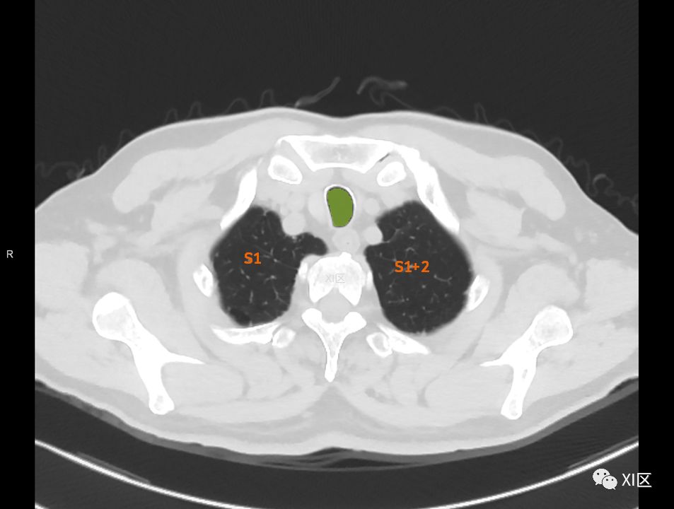 如此详细的肺部影像解剖，有点儿酷！
