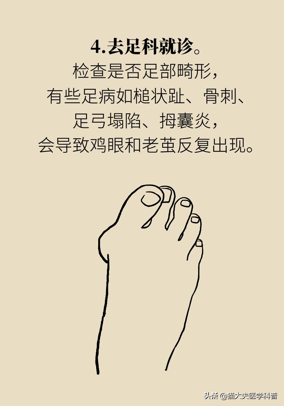 鸡眼好了长了一层老茧,鸡眼与老茧的区别图片