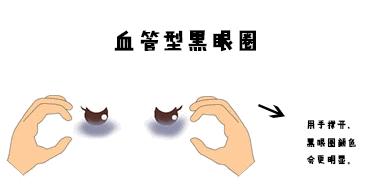 明明没有熬夜，黑眼圈就是去不掉？试试这个办法吧