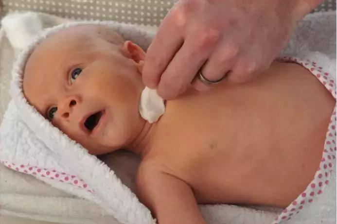 宝宝高热惊厥不要慌，家长做对这几点宝宝才能安然无恙