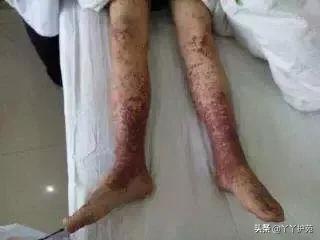 儿科常见出疹性疾病,儿科常见出疹性疾病有哪些