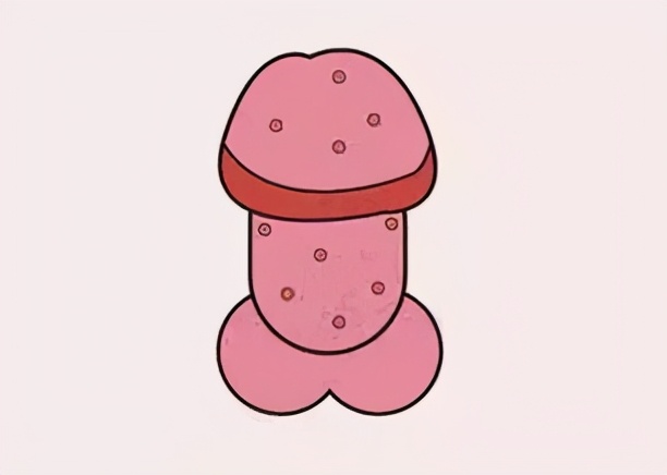 丁丁上怎么长了“小疙瘩、小红点”？难道是染上了性病？