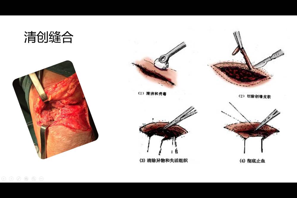 如何停止自己的焦虑情绪,治愈内心的焦虑情绪