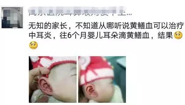 酱油清肠,避孕药洗头,这些自杀式养生为什么总有人信?