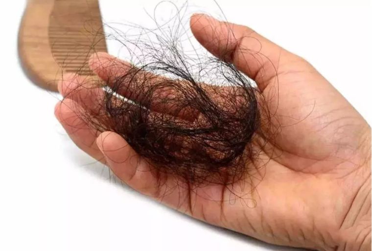 哪些食谱可以改善脱发,治脱发且好吃的零食