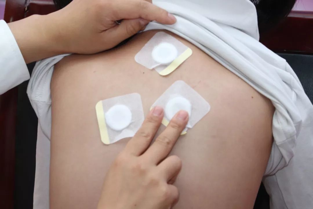 小儿发热该怎么治,小儿发热处理方法中医