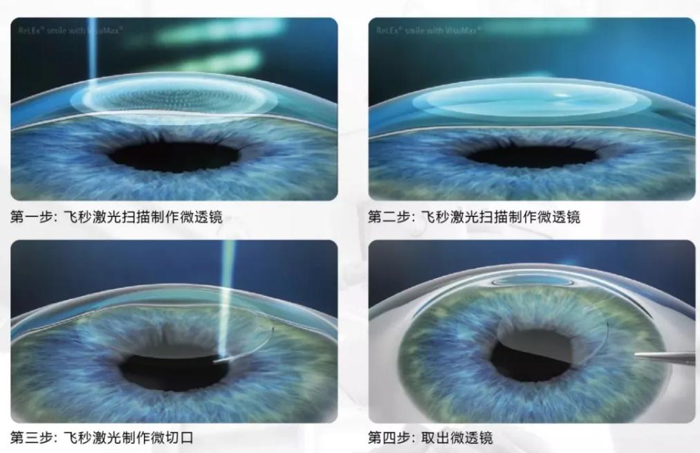 鐗涜浆涔惧潳瓒崇悆,鐗涜浆涔惧潳绐佸嚭閲嶅洿