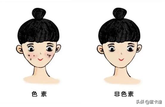 全部皮肤知识大全,四张图让你明白你是什么皮肤