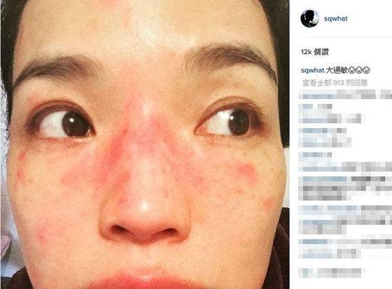 「丽皙白」脸部时常感到有刺痛感,那是你还没做好这几步护肤步骤!