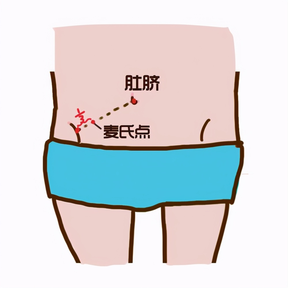 一张腹部地图了解腹痛,一张图让你知道腹部哪里疼